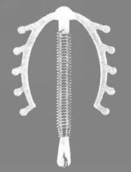 避孕器＿子宮內避孕器